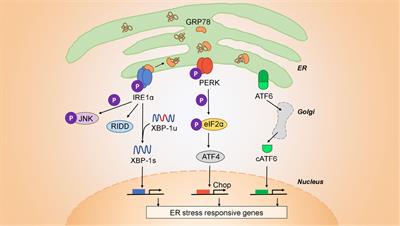 The Unfolded Protein Response at the Tumor-Immune Interface